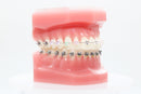 CASO BRACKET AUTOLIGANTE CLEAR 21