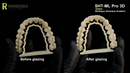 SHT-ML PRO 3D ZIRCONIO MULTILAYER, RONDCERA