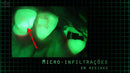 EVIDENCIADOR CLÍNICO, EVINCE