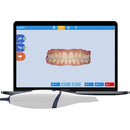 SCANNER DENTAL 3D, PORTÁTIL